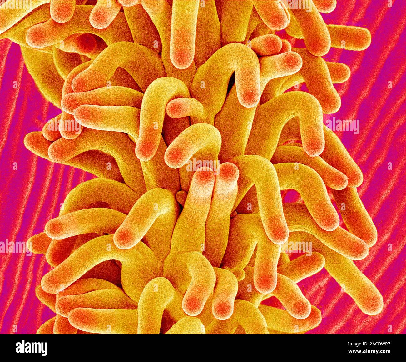 Chickweed flower pistil. Coloured scanning electron micrograph (SEM) of ...