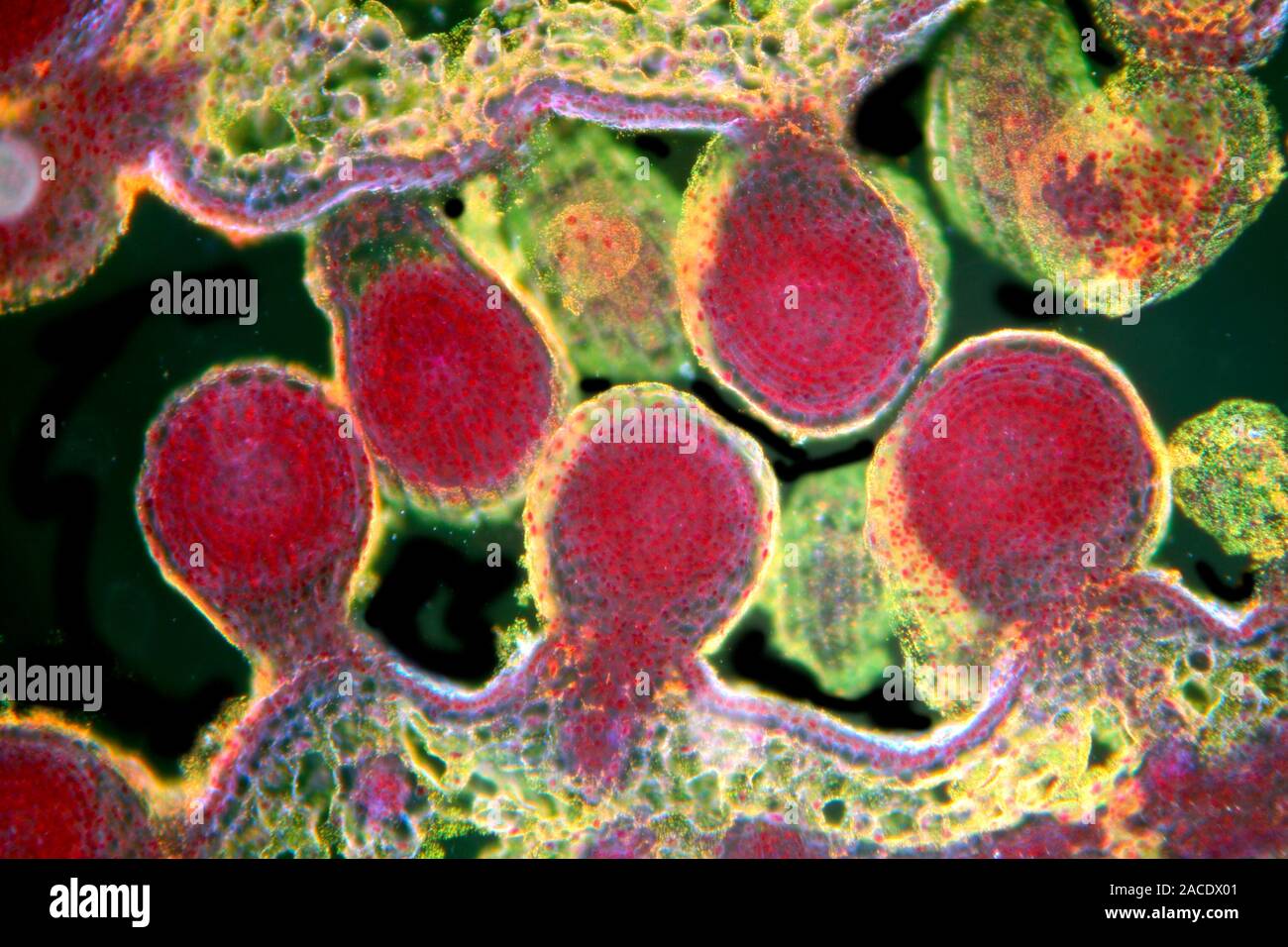 Poppy ovary with developing seeds. Light micrograph (LM) of a cross