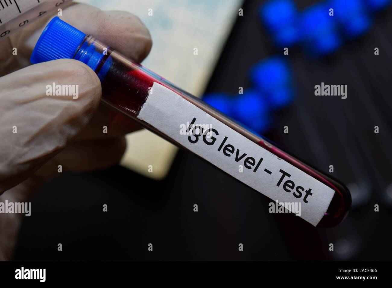 Igg4 hires stock photography and images Alamy Igg4 hires stock photography and images Alamy