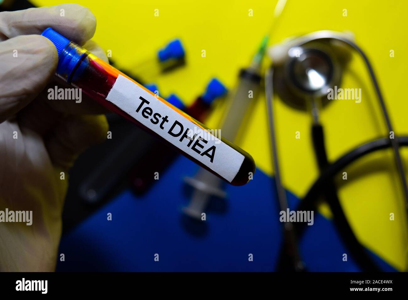 Test Dhea text with blood sample. Top view isolated on office desk