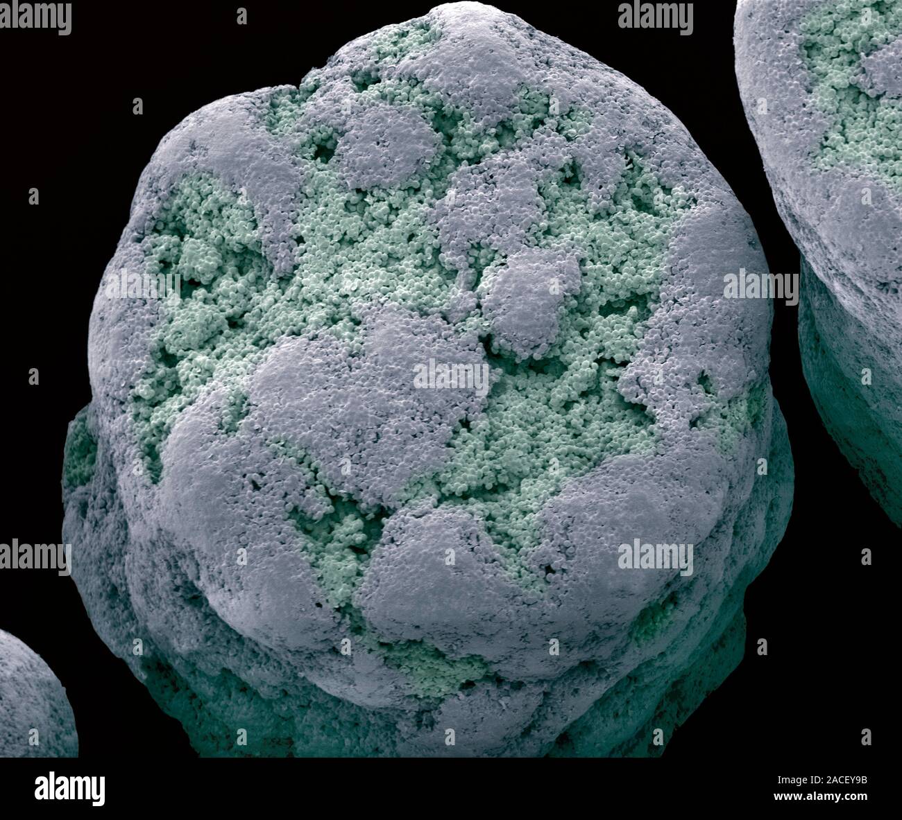 Dried commercial yeast pellet. Coloured scanning electron micrograph