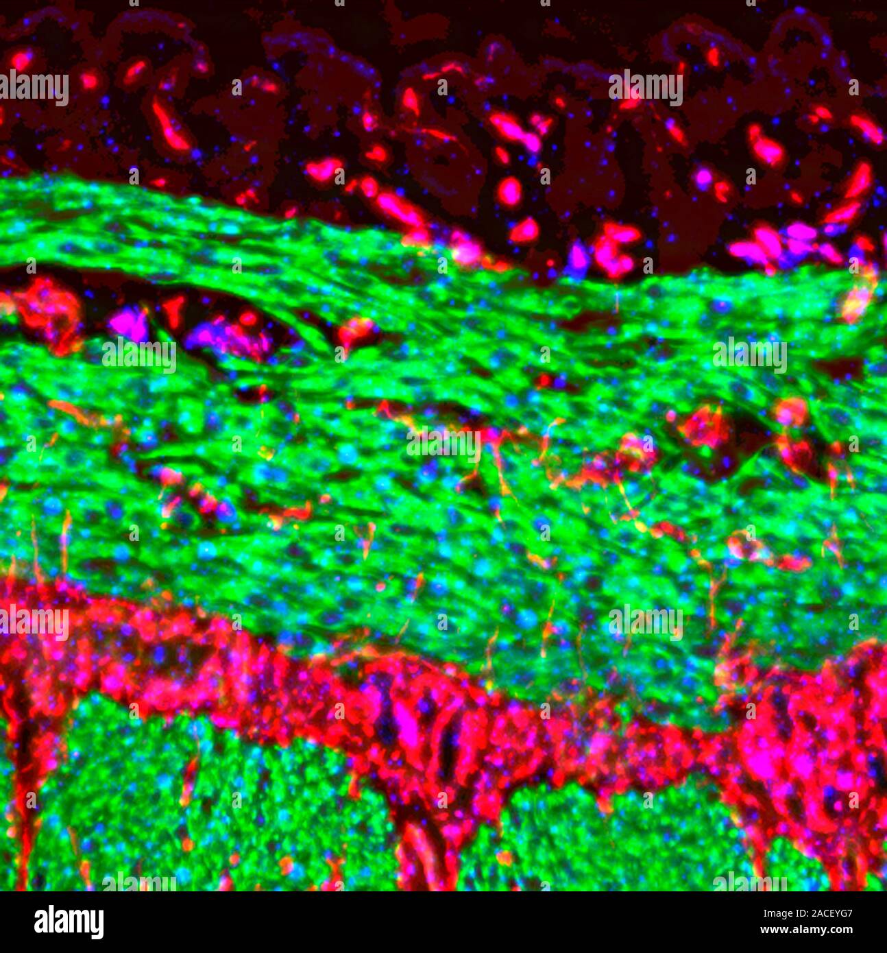 Small intestine. Fluorescence deconvolution micrograph showing a ...