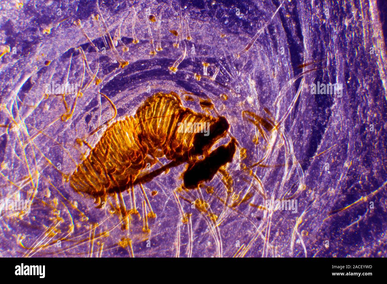 Caterpillar proleg. Dark-field light micrograph of part of the skin of ...