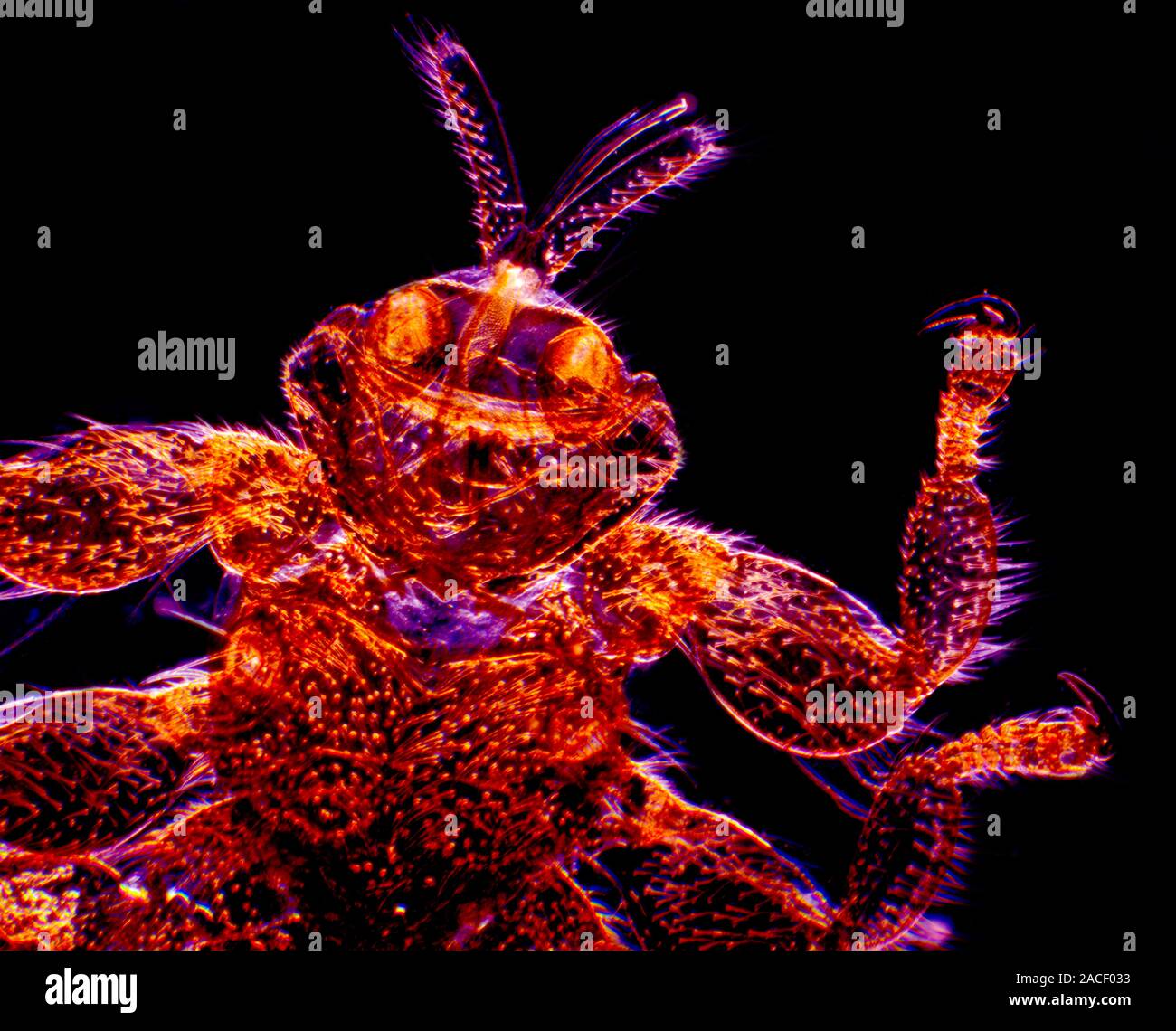 Sheep ked. Darkfield light micrograph of the headend of the body of