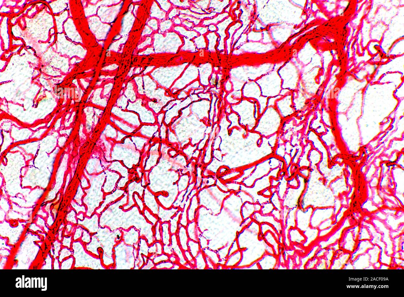 Сосудистые ткани под микроскопом. Сосуды под микроскопом. Нейроны мозга под микроскопом. Ксилема ткань под микроскопом. Сосуды под микроскопом.