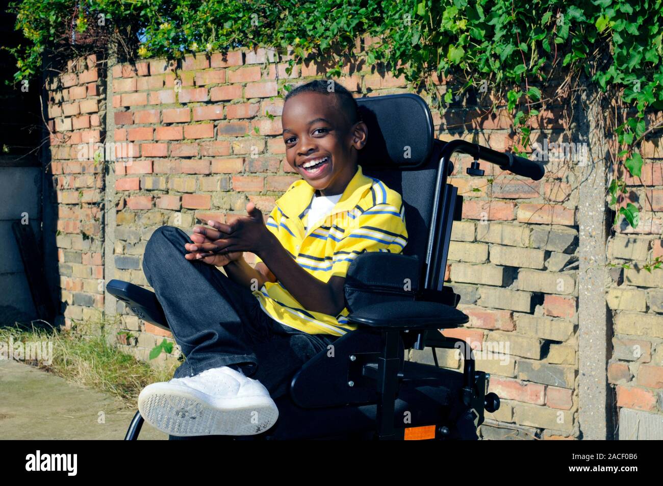 Cerebral palsy child. 10 year old boy with cerebral palsy in a ...