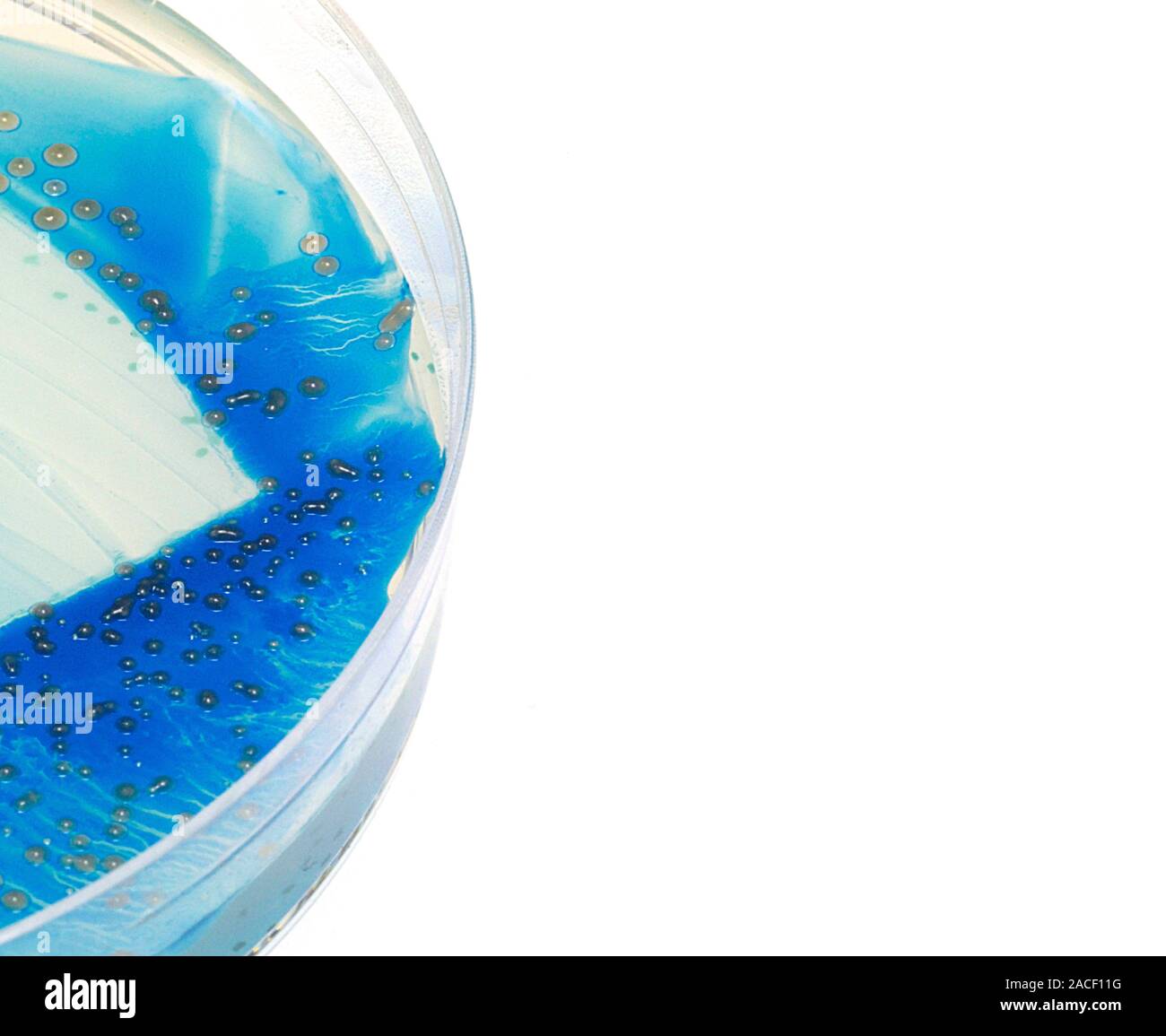 Bacterial culture. Petri dish containing bacterial cultures (green