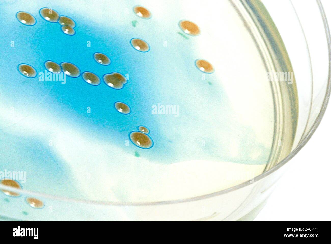 Bacterial culture. Petri dish containing bacterial cultures (brown