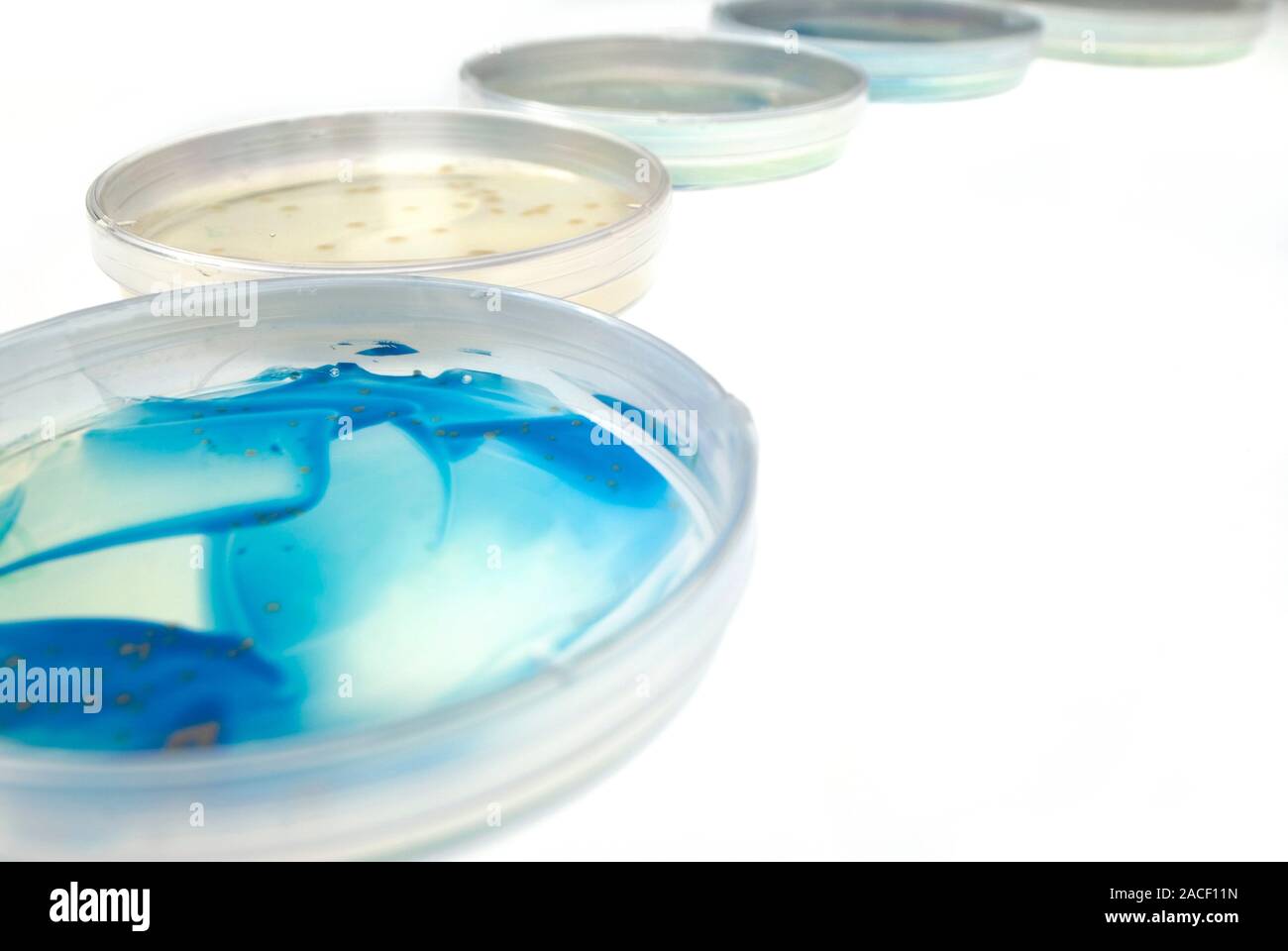Bacterial culture. Row of petri dishes containing bacterial cultures
