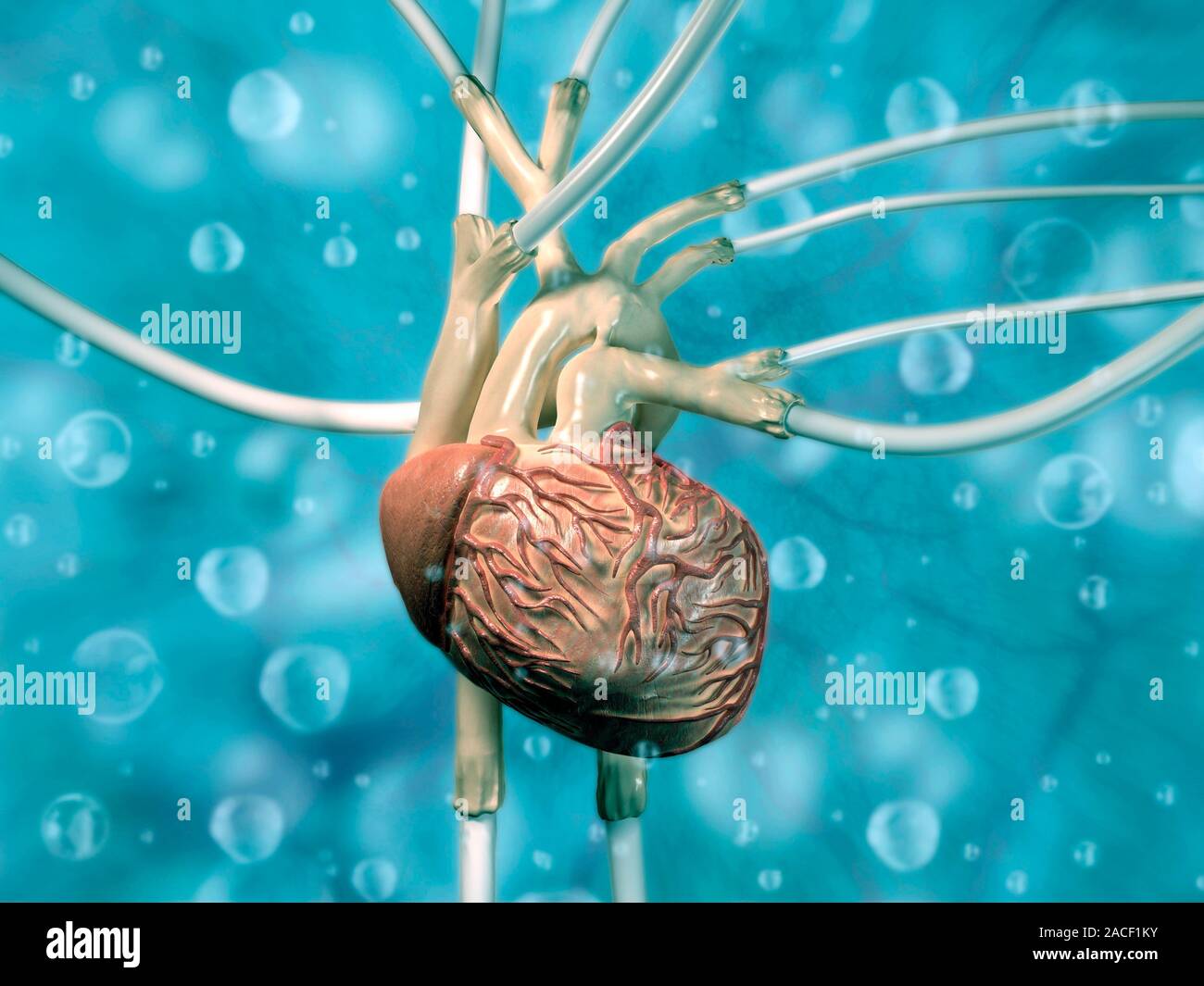 Artificial heart. Conceptual computer artwork of an artificial heart