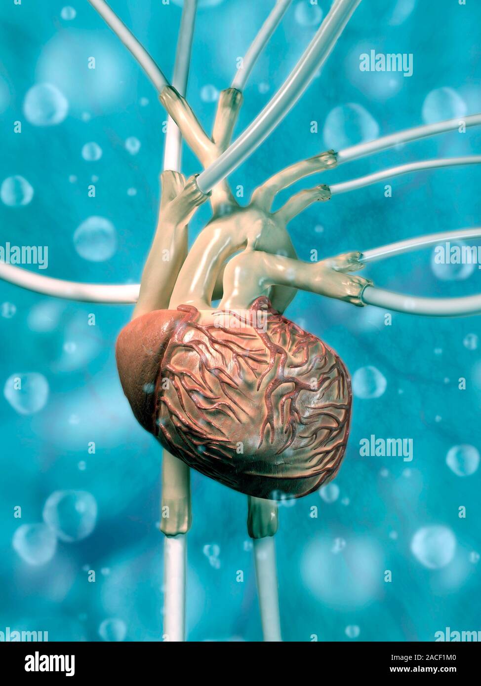 Artificial heart. Conceptual computer artwork of an artificial heart