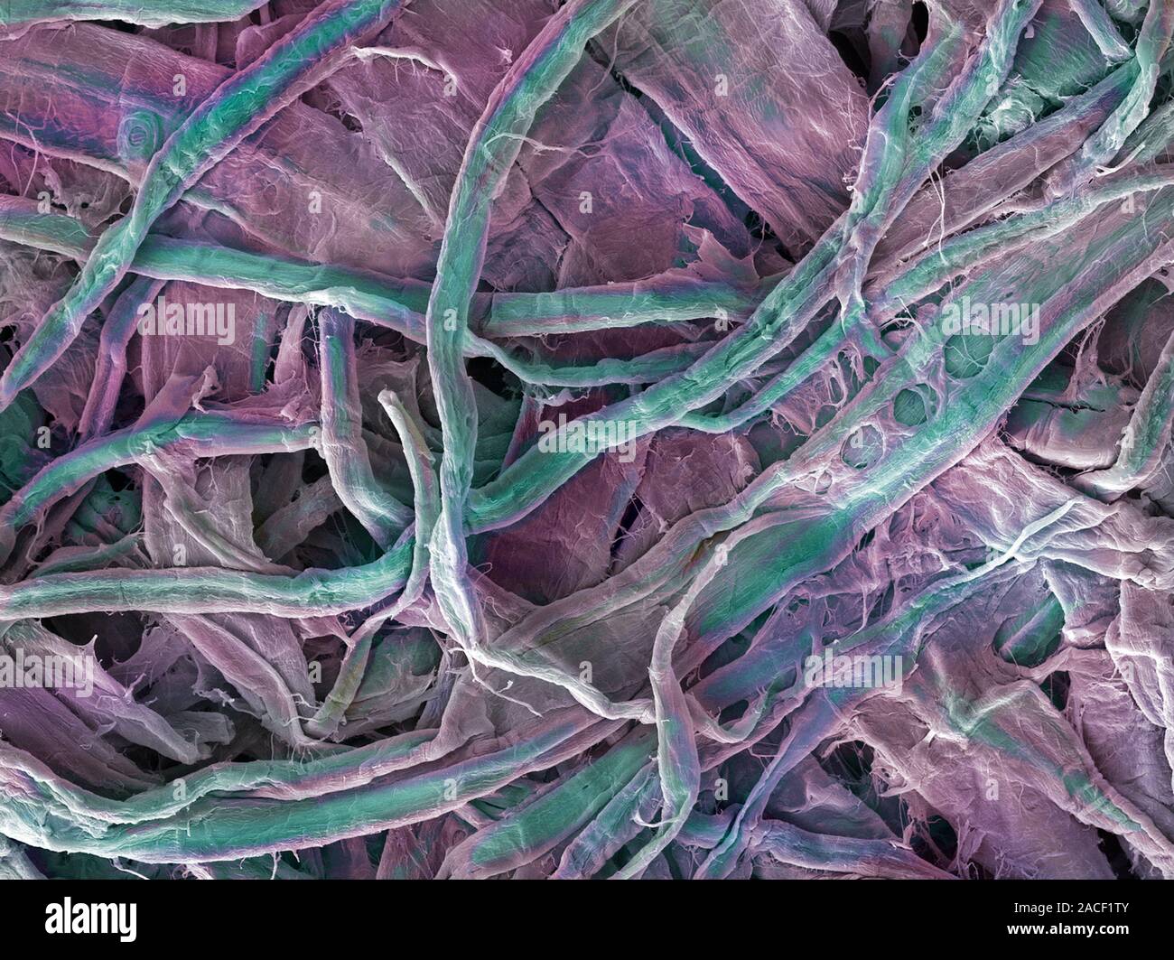 Kitchen paper towel fibres. Coloured scanning electron micrograph (SEM ...