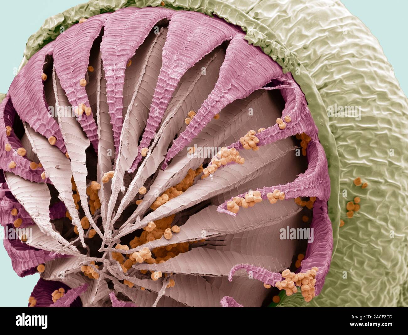 Moss spore capsule. Coloured scanning electron micrograph (SEM) of the