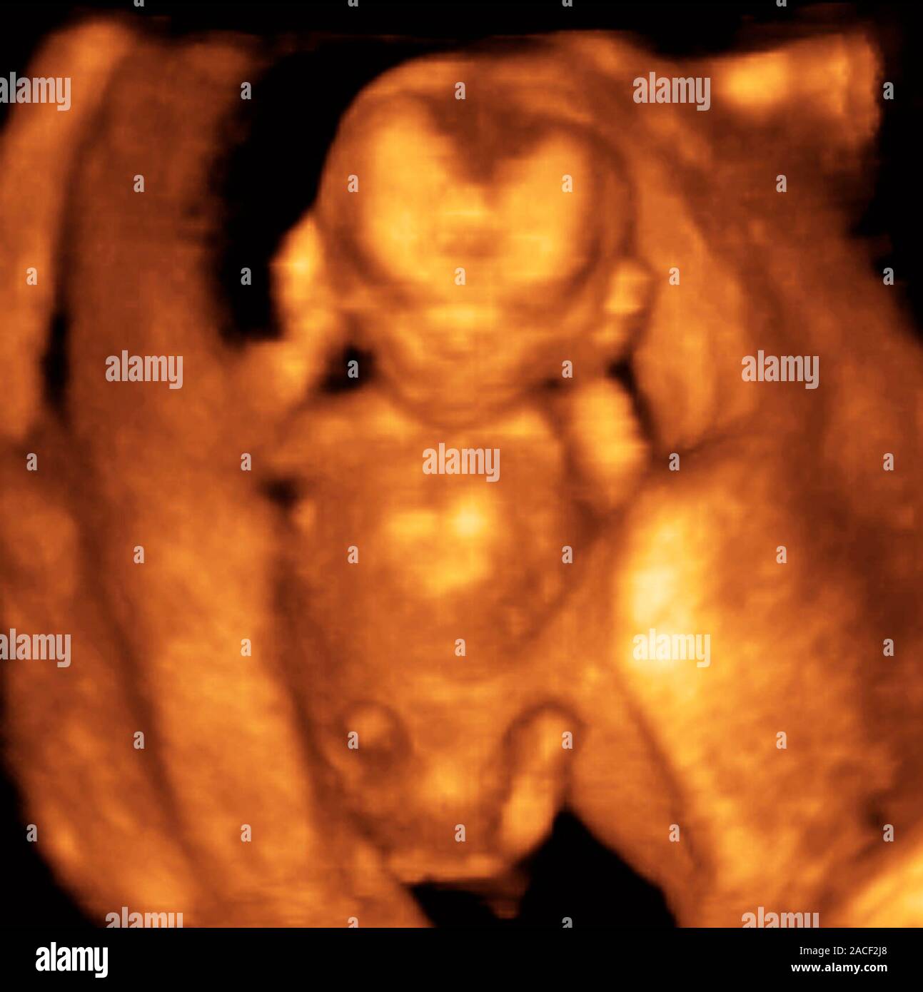 foetus-at-12-weeks-3d-ultrasound-scan-stock-photo-alamy