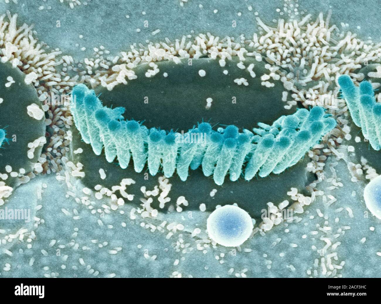 Inner ear hair cells. Coloured scanning electron micrograph (SEM) of sensory hair cells from the cochlea of the inner ear. The hairs are surrounded by Stock Photo