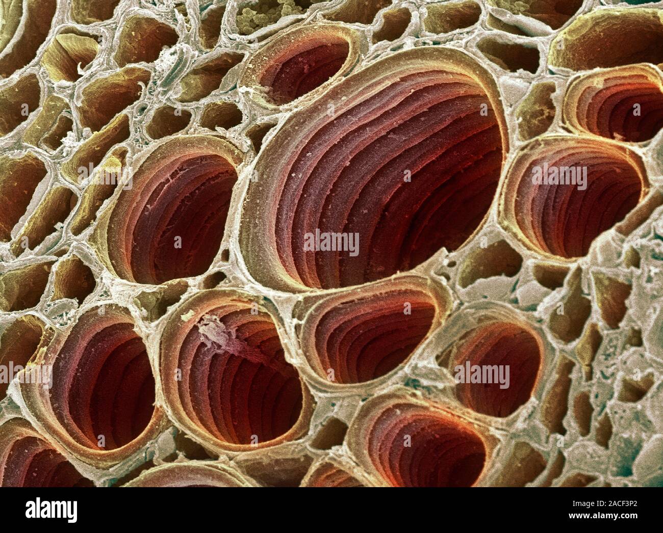 Xylem plant cells. Coloured scanning electron micrograph (SEM) of xylem cells from a plant leaf