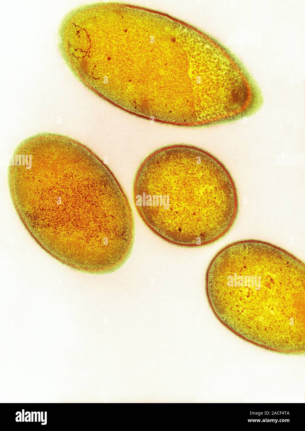 Clostridium difficile bacteria, coloured transmission electron