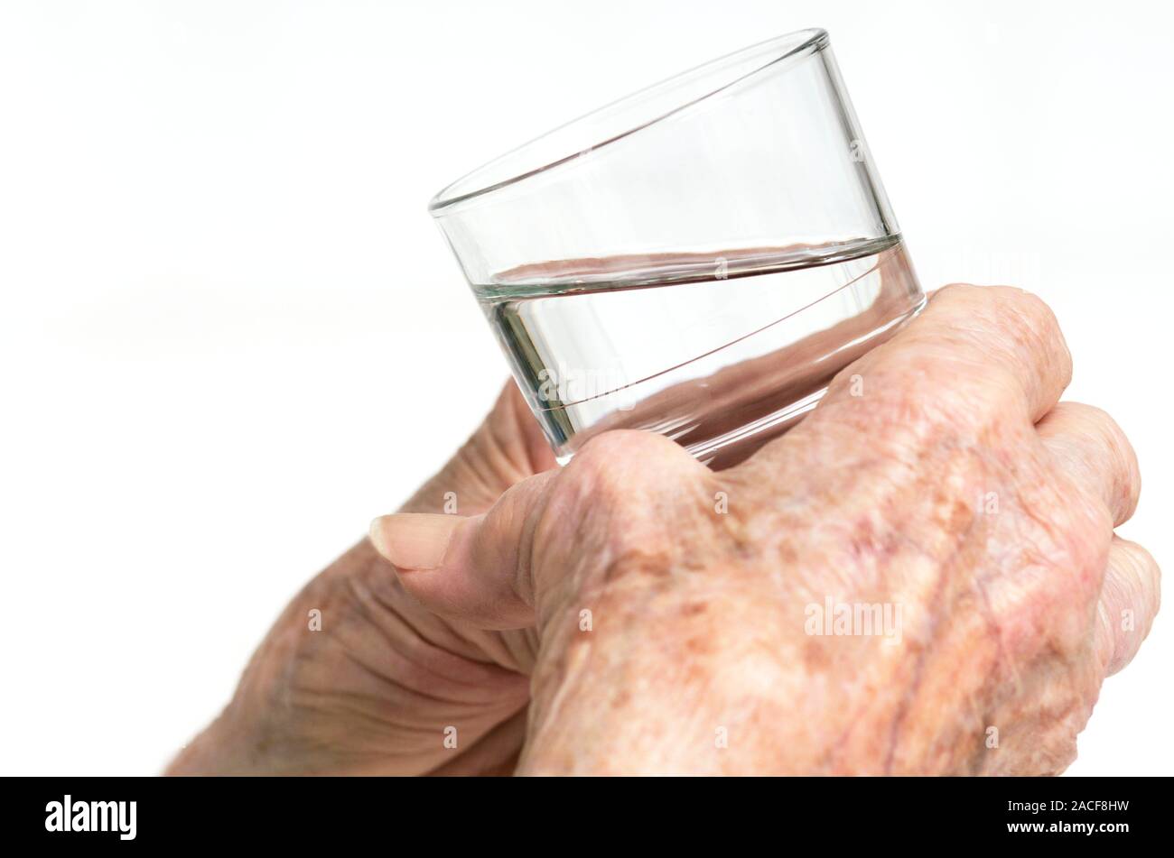 Arthritic hands. Elderly woman's arthritic hands attempting to hold a