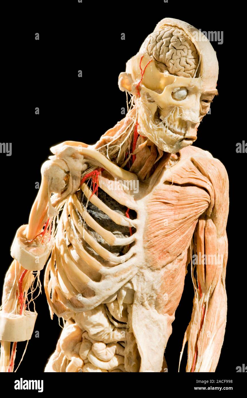 Plastinated body exhibit, following dissection. The technique of  plastination conserves dead bodies by replacing water and fat with plastic.  The techn Stock Photo - Alamy