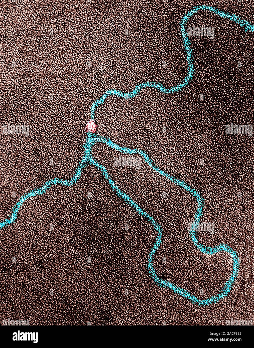 DNA (deoxyribonucleic acid) molecule, coloured transmission electron
