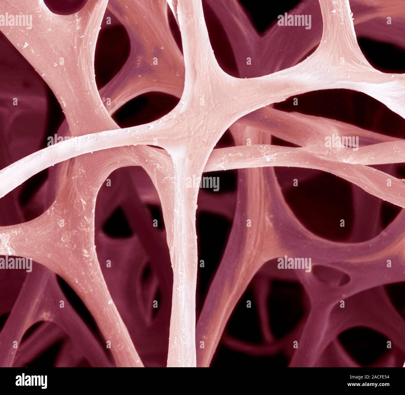 Bird bone tissue. Coloured scanning electron micrograph (SEM) of ...