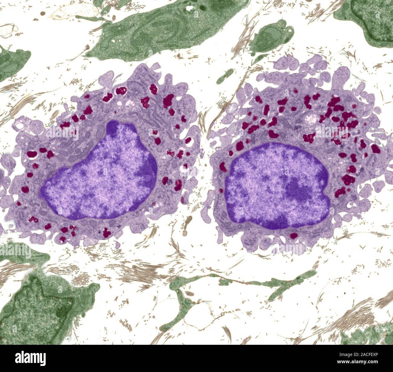 Макрофаги 1 3. Фагоцитоз гистология. Фагоцитоз микроскопия. Тканеспецифические макрофаги. Макрофаги под микроскопом.