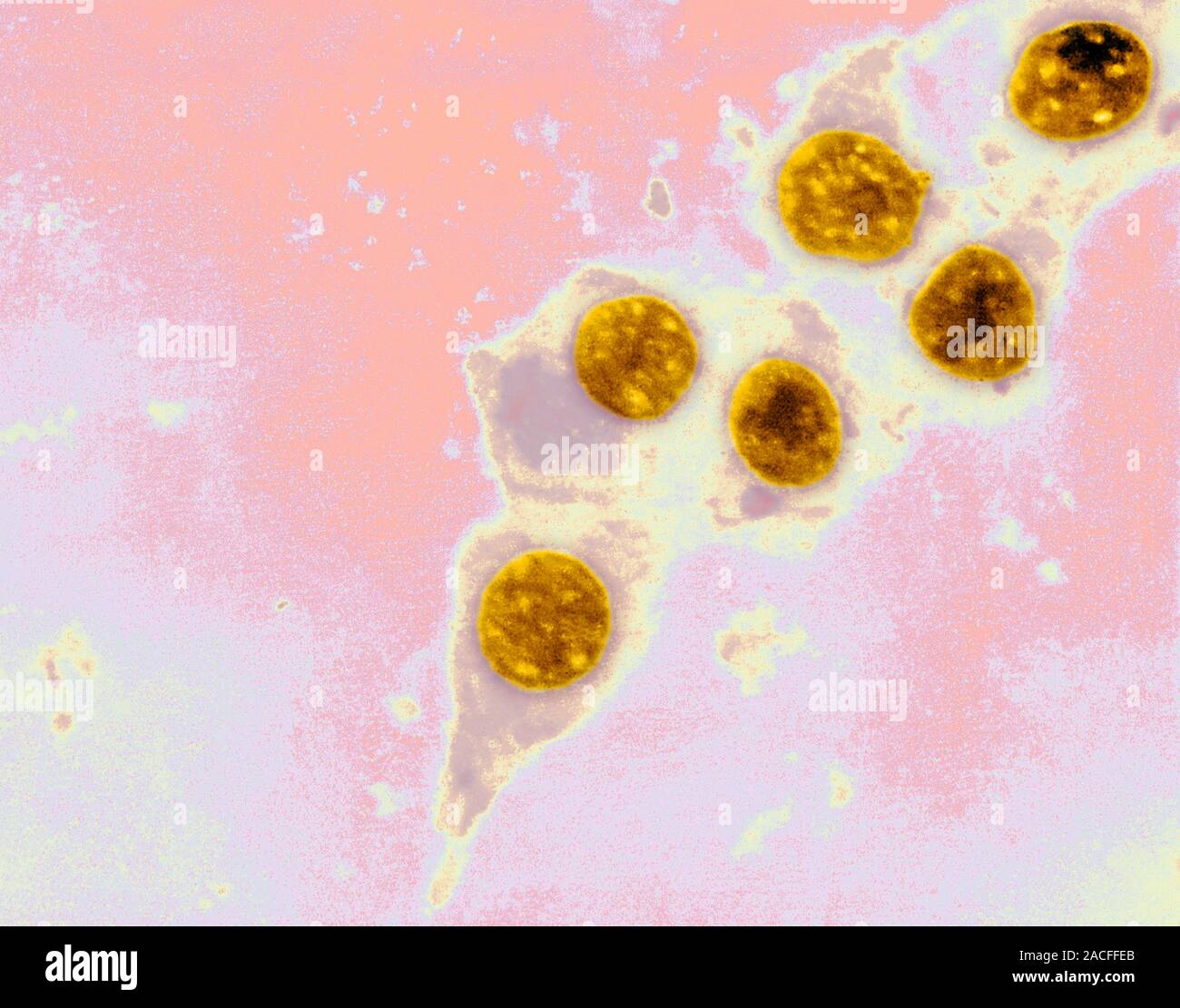 Chlamydia Trachomatis Bacteria Coloured Transmission Electron Micrograph Tem These Spherical 6951