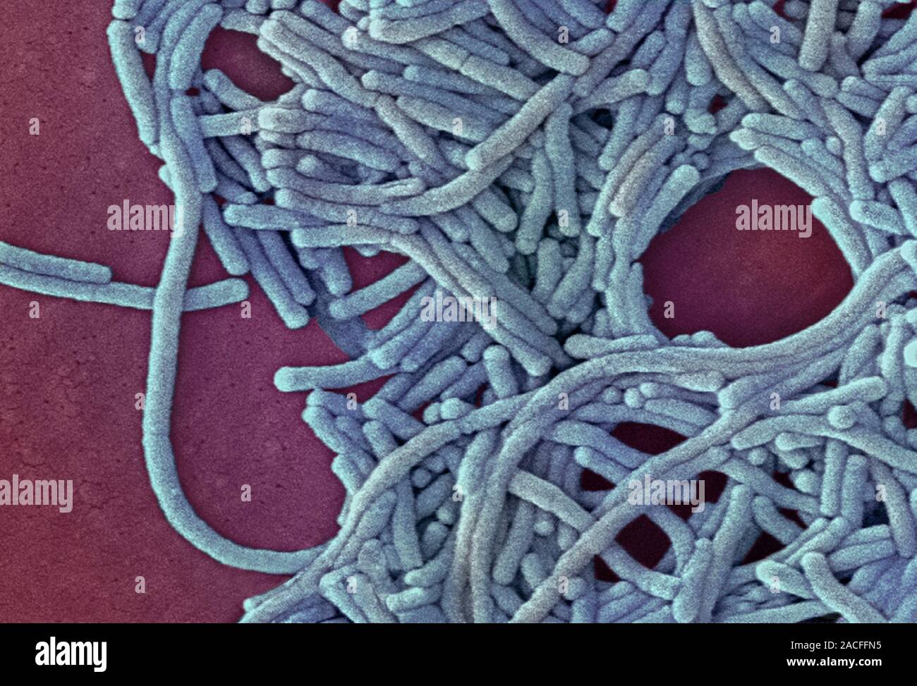 Legionella bacteria. Coloured scanning electron micrograph (SEM) of Legionella pneumophila