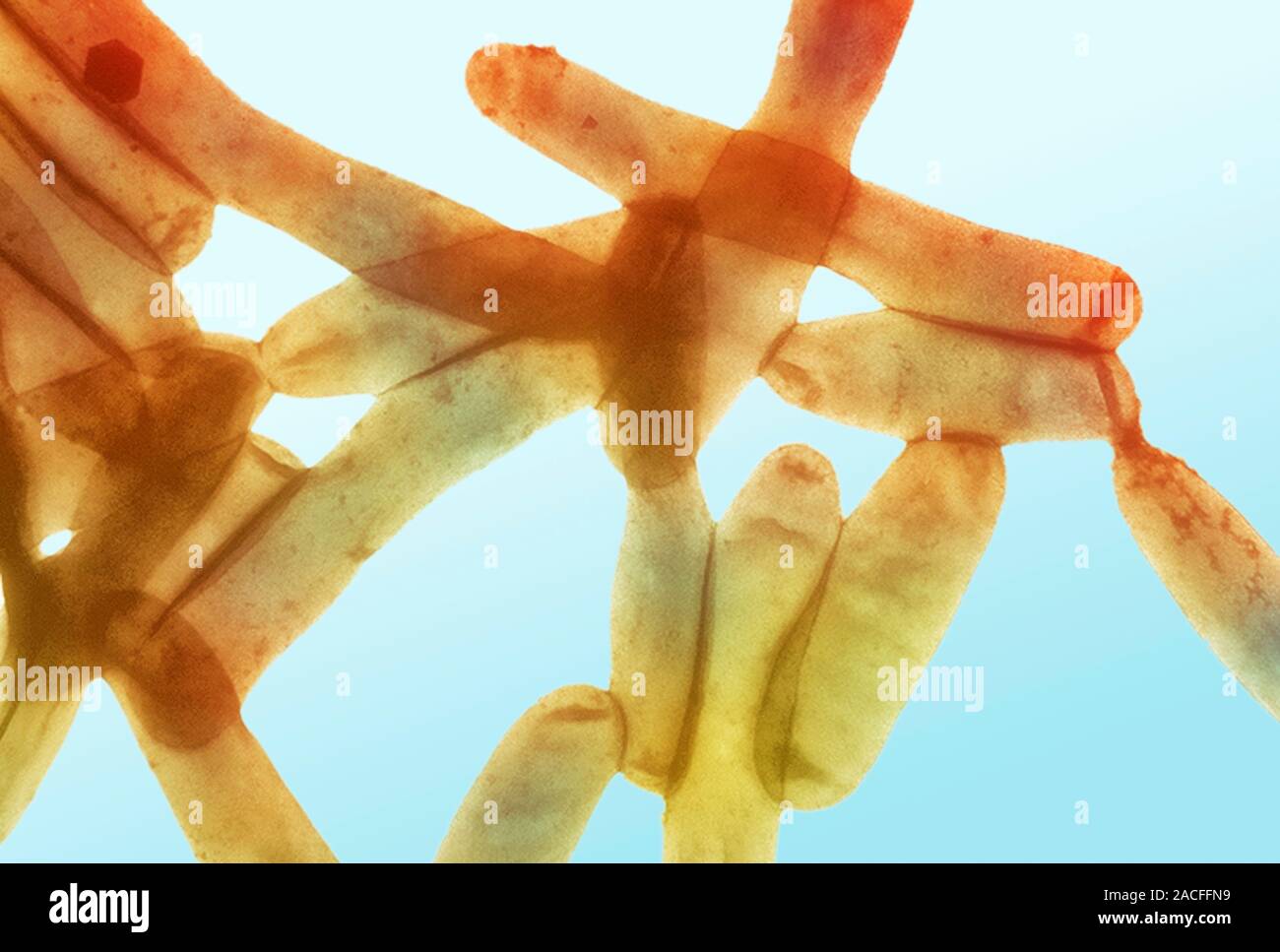 Legionella bacteria. Coloured light micrograph of Legionella