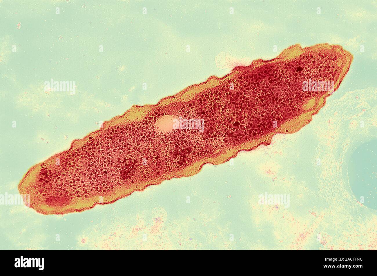 Legionella bacteria. Coloured transmission electron micrograph of a Legionella pneumophila
