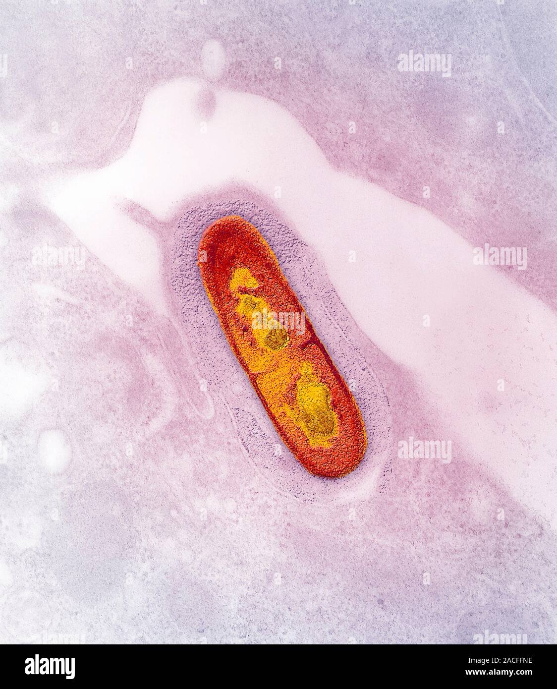 Listeria sp. bacteria, coloured transmission electron micrograph (TEM ...