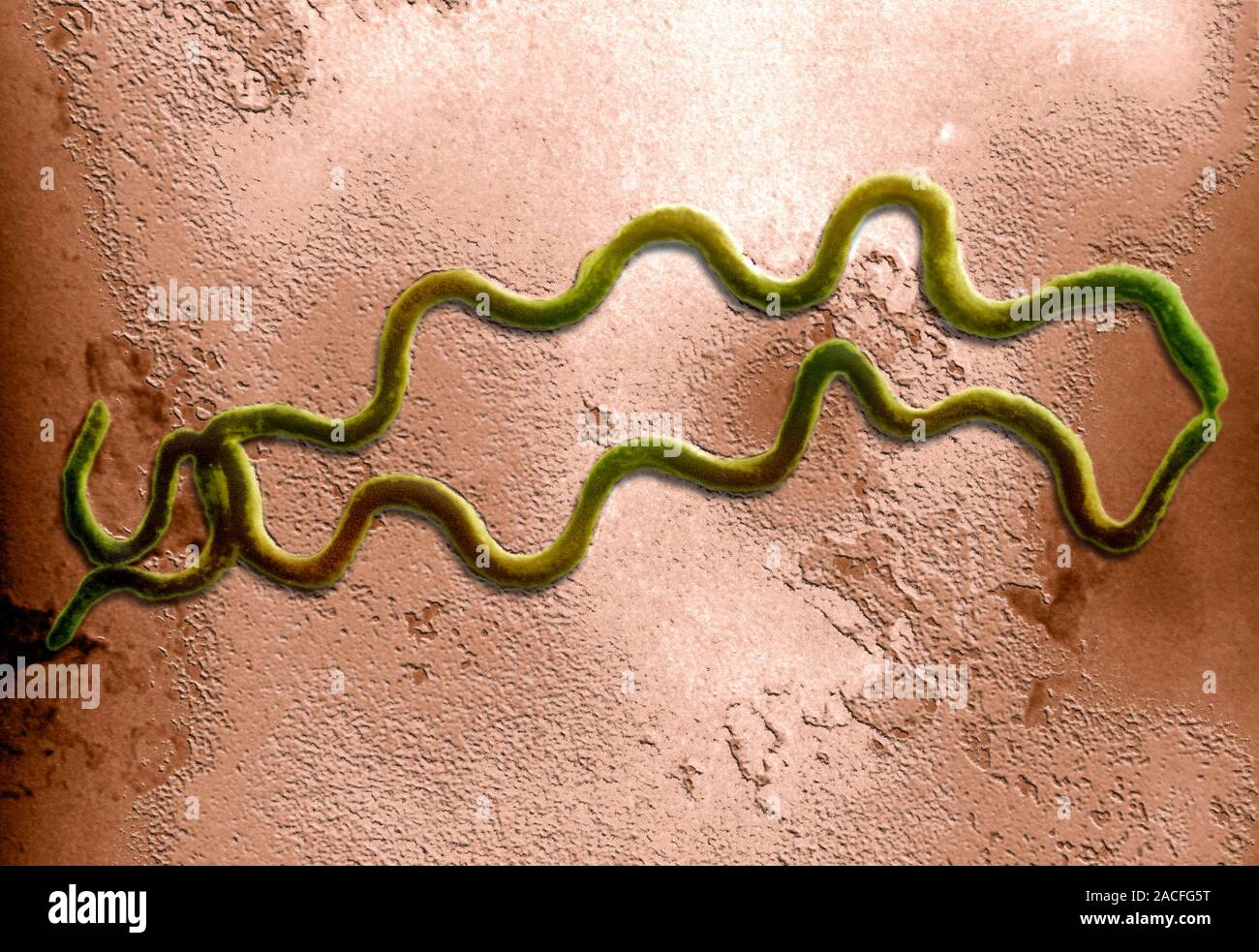 Syphilis Bacterium Coloured Transmission Electron Micrograph Tem Showing The Spirochaete 0097