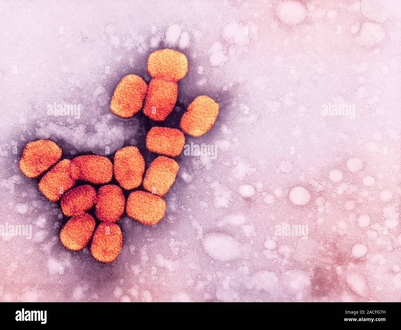 Smallpox virus particles. Coloured transmission electron micrograph ...