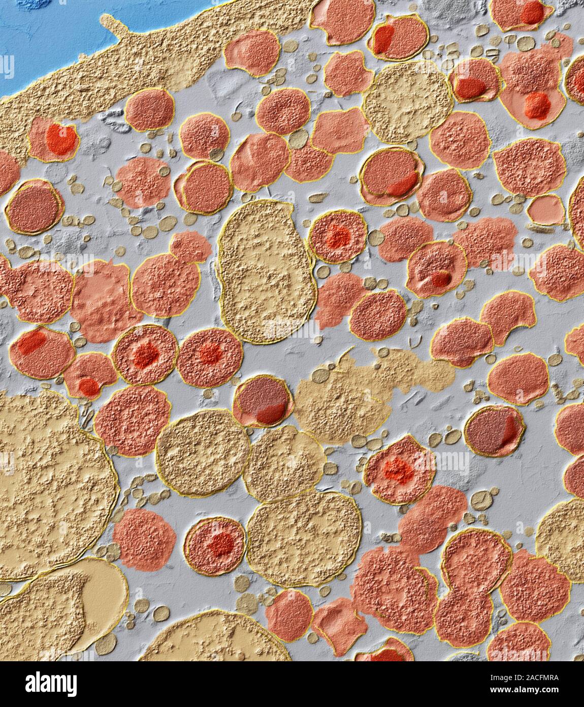 Chlamydia trachomatis bacteria, coloured transmission electron