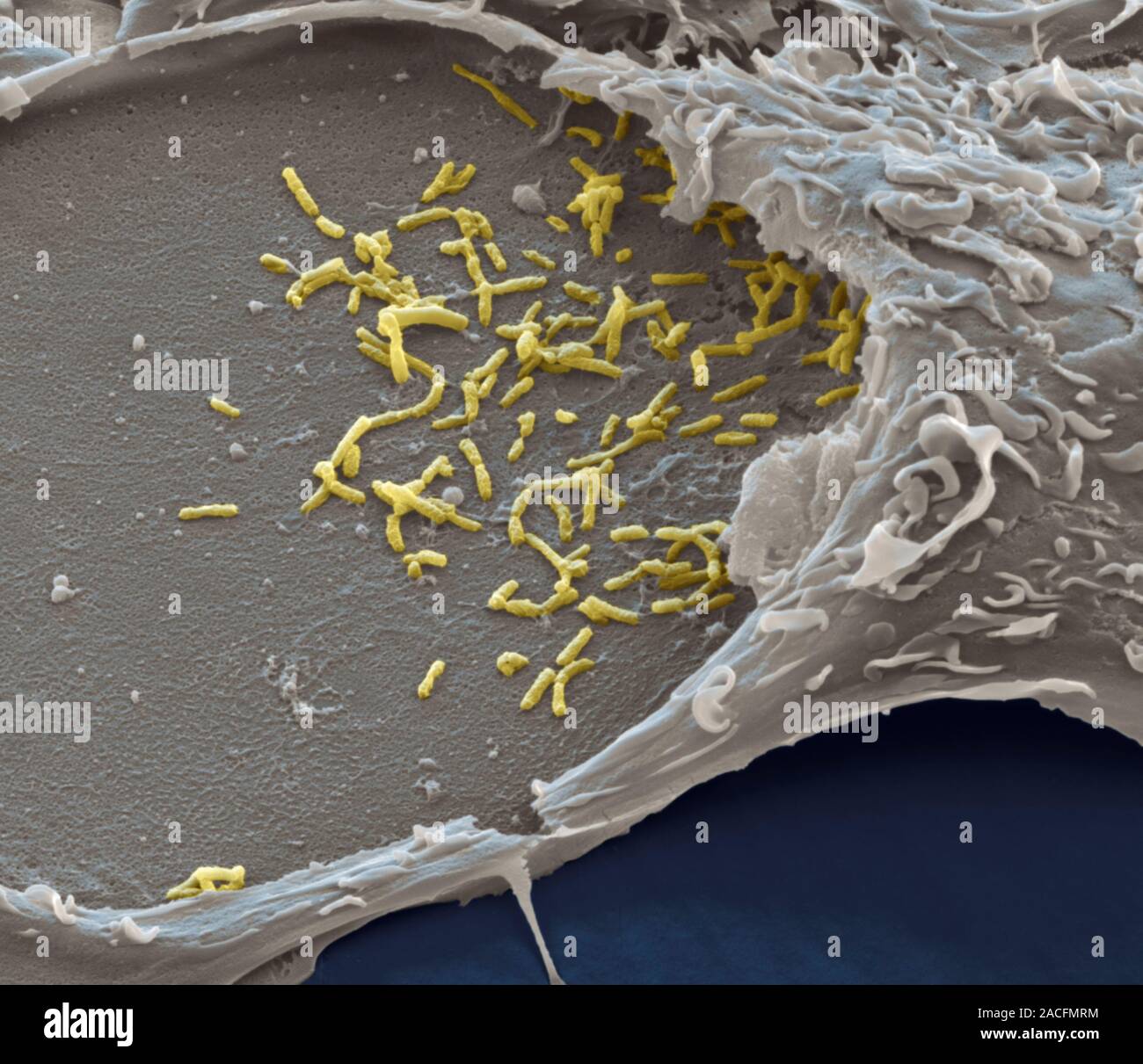 Yellow Germs Q fever bacteria (Coxiella burnetii, yellow), coloured transmission ...