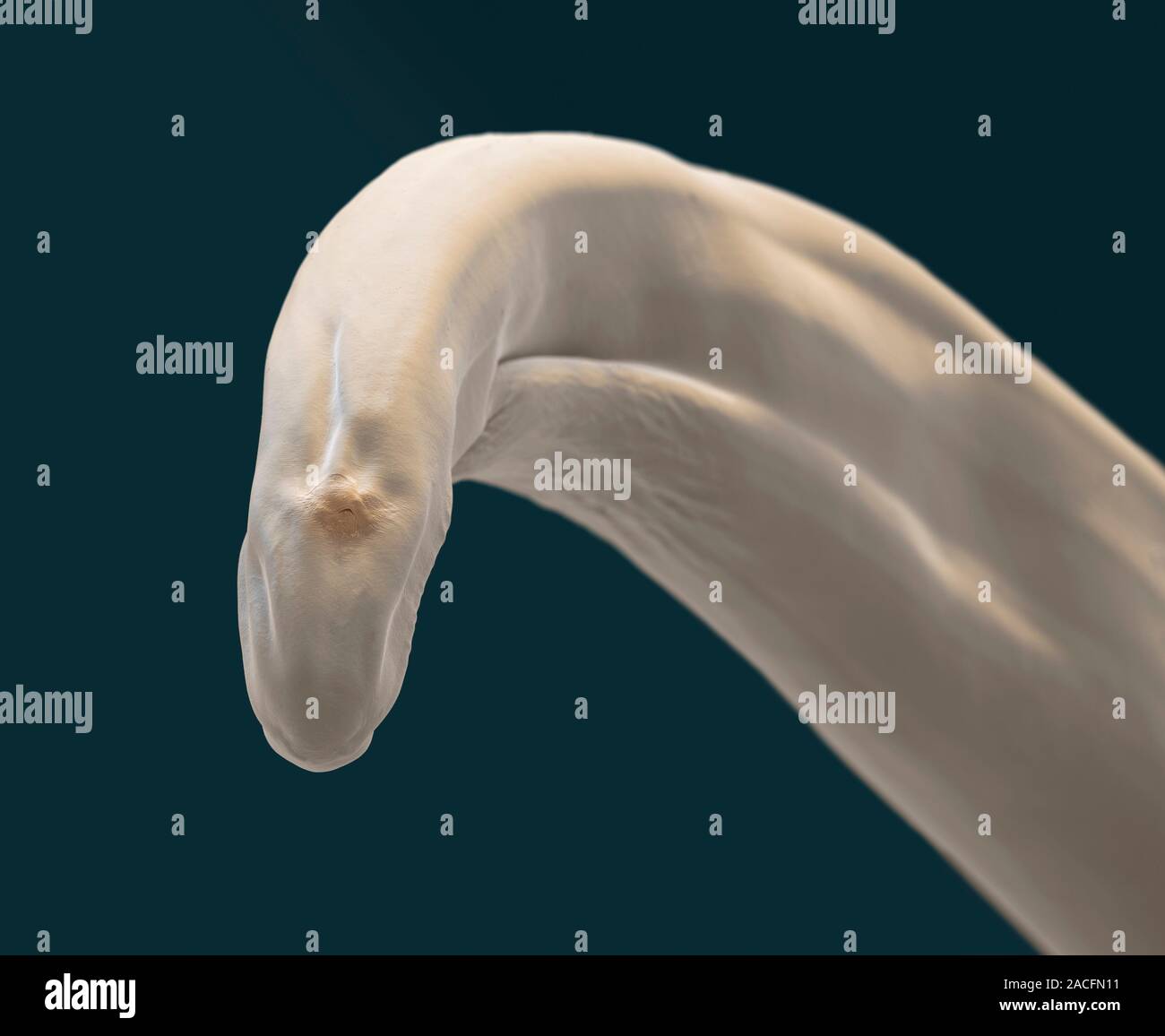 Heartworm. Coloured scanning electron micrograph (SEM) of the tail of a ...