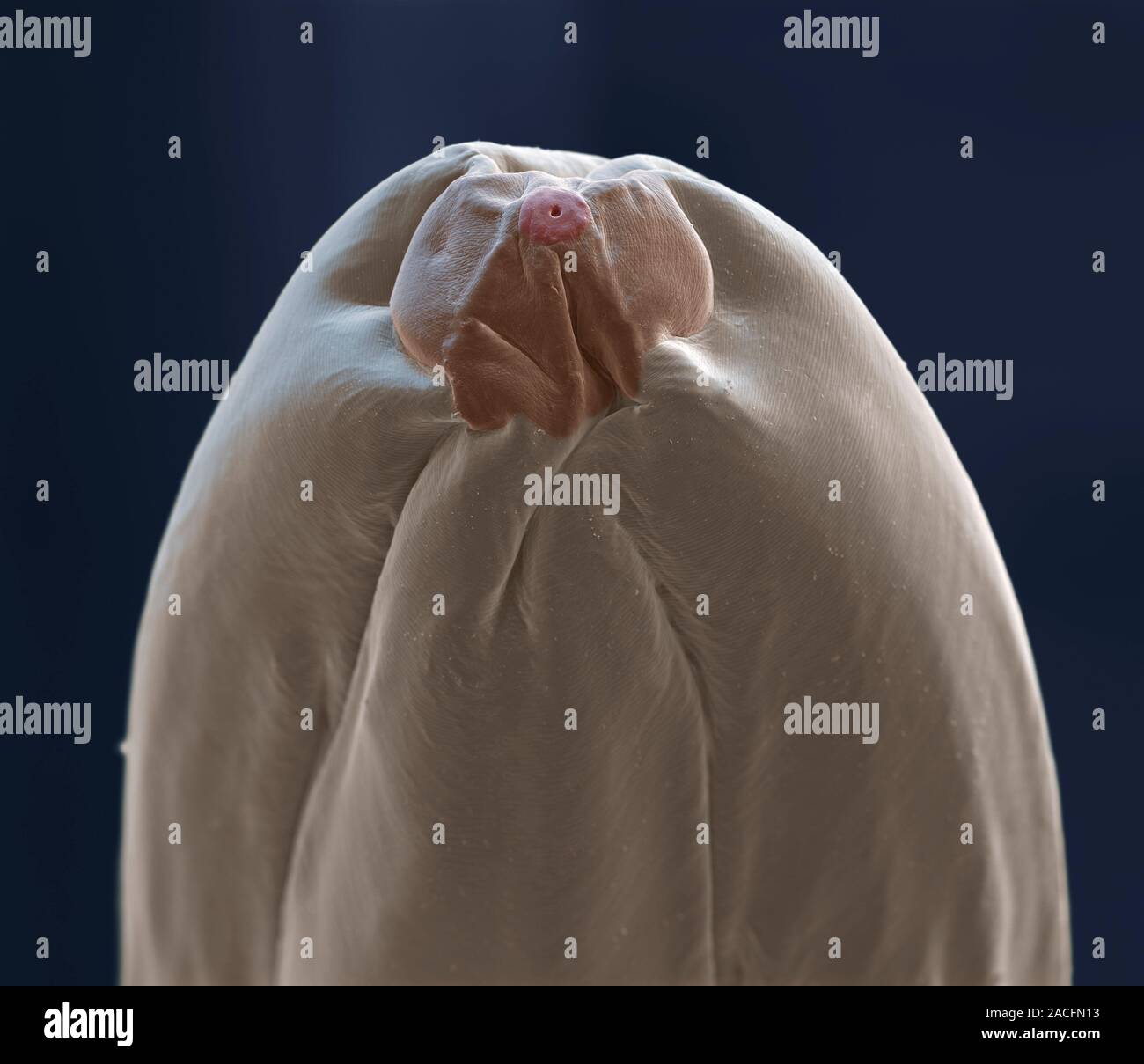 heartworm-coloured-scanning-electron-micrograph-sem-of-the-head-of-a