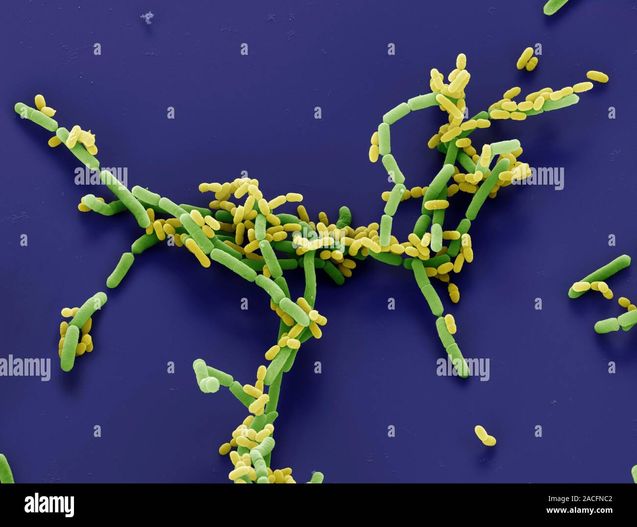 Lactobacillus paracasei bacteria (green), coloured scanning electron
