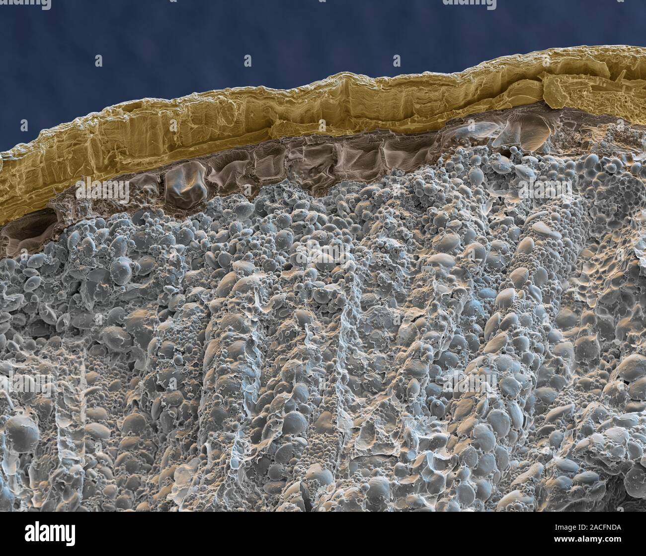 Rye grain. Coloured scanning electron micrograph (SEM) of a section