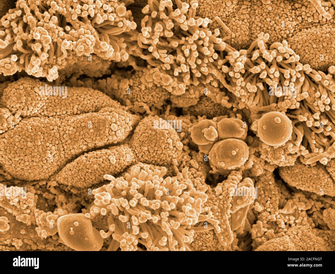 Trachea lining, coloured scanning electron micrograph (SEM). The