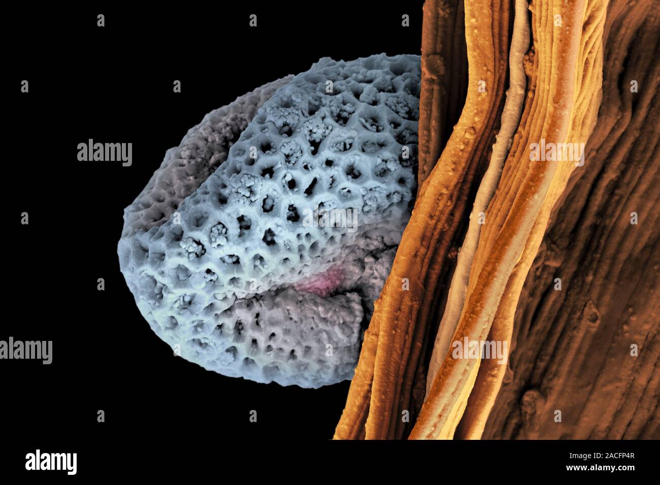 Pollen grain sticking to an anther, scanning electron micrograph (SEM). Pollen grains are