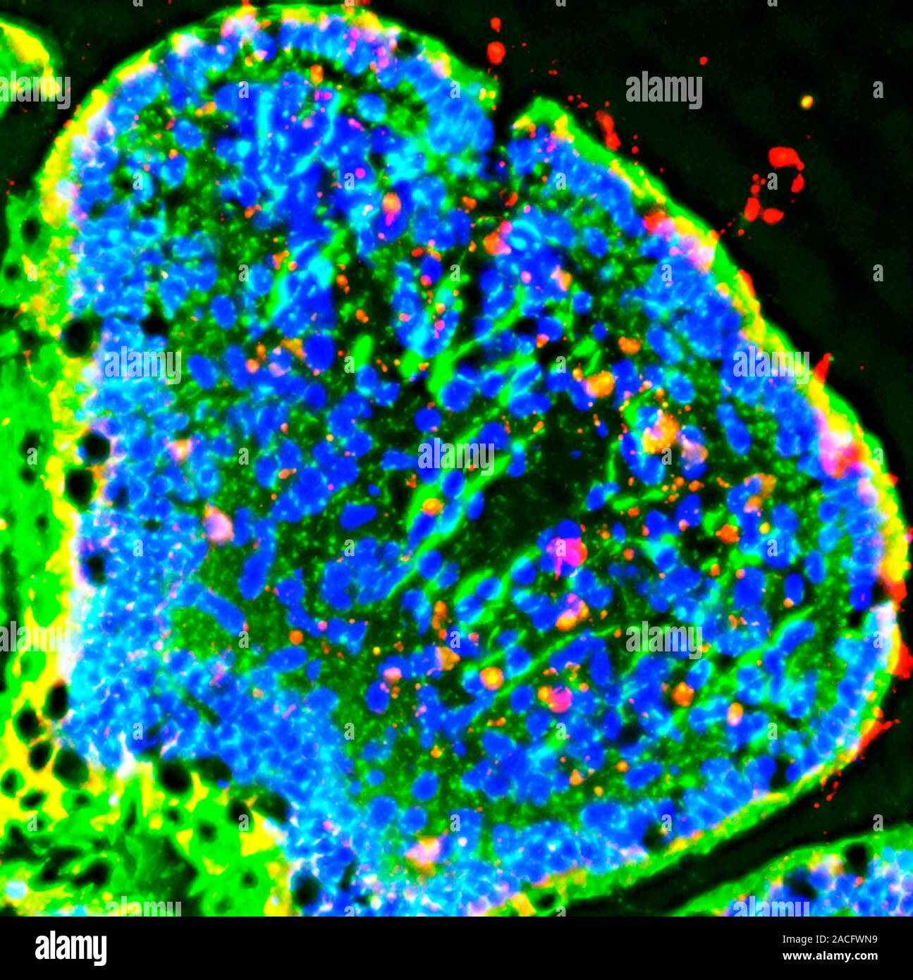 Peyer's patch. Fluorescent deconvolution micrograph of a section ...