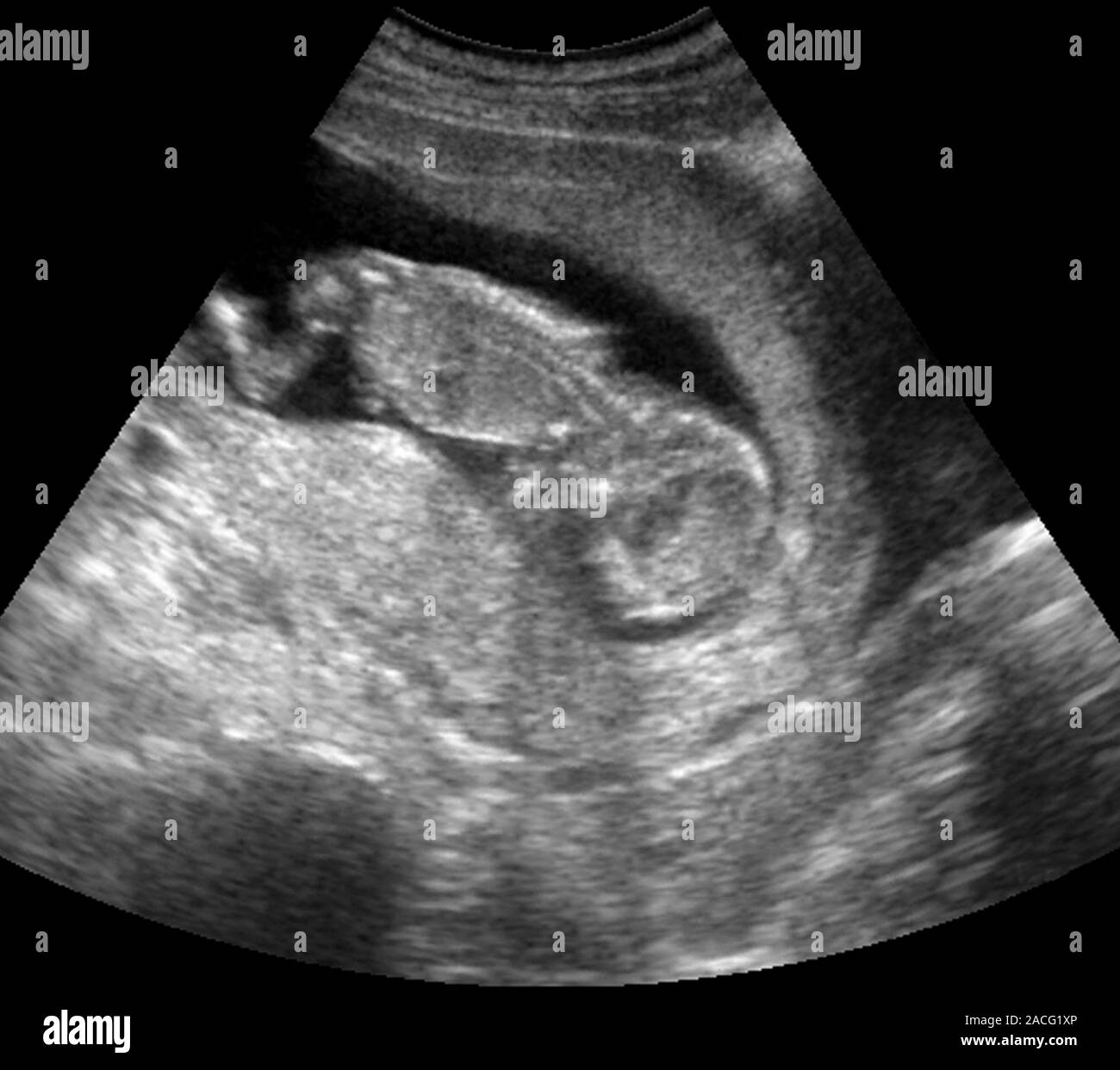 Что происходит на 12 неделе. 12 Недель беременности фото плода на УЗИ. Снимки УЗИ беременности 12 недель. УЗИ малыша на 12 неделе беременности фото.