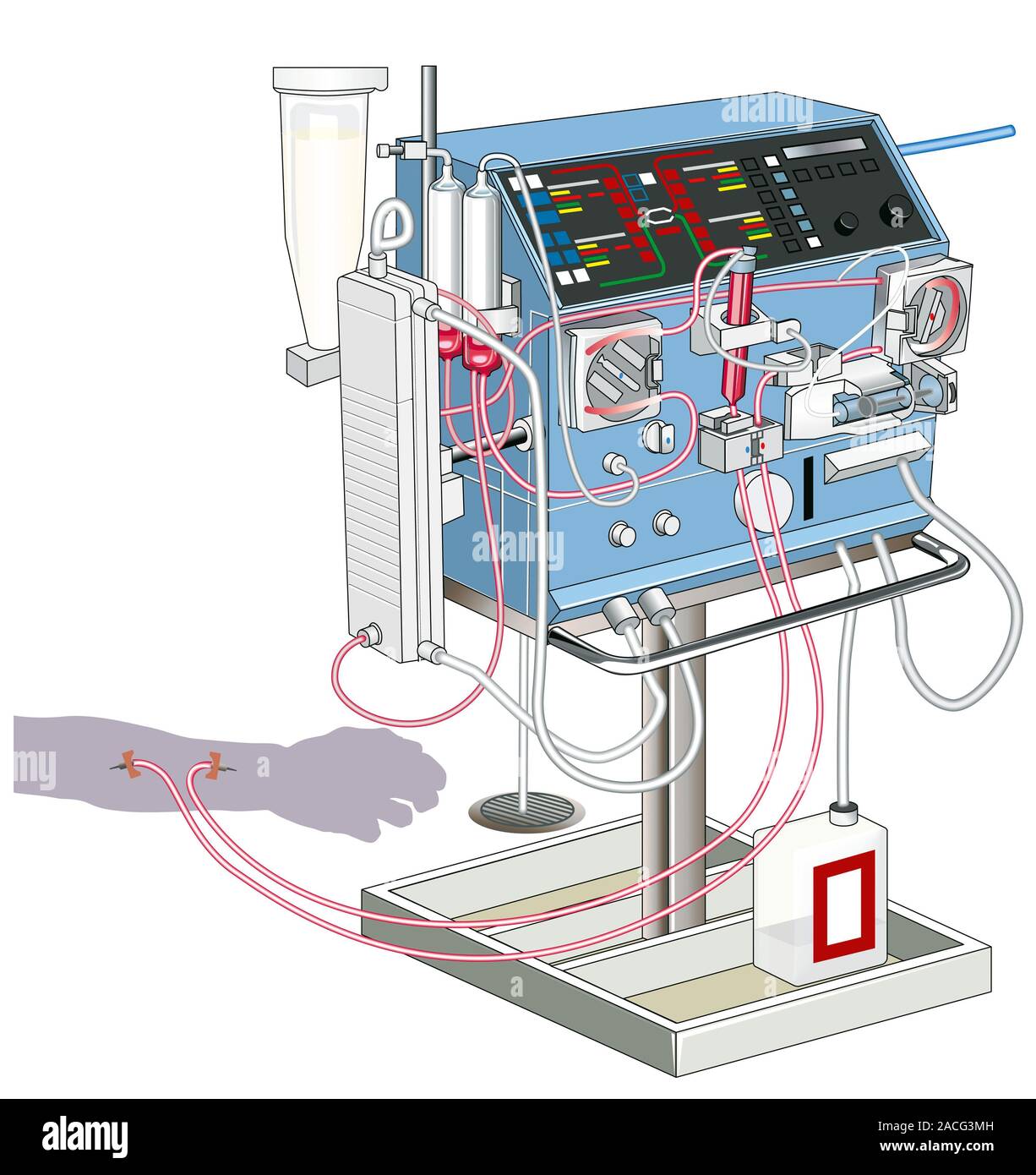 Kidney dialysis machine, computer artwork. Kidney dialysis