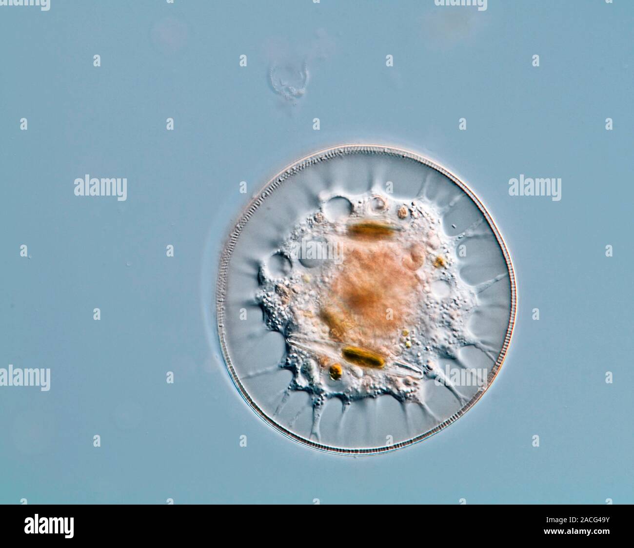 Shelled amoeba. Differential interference contrast micrograph of the ...