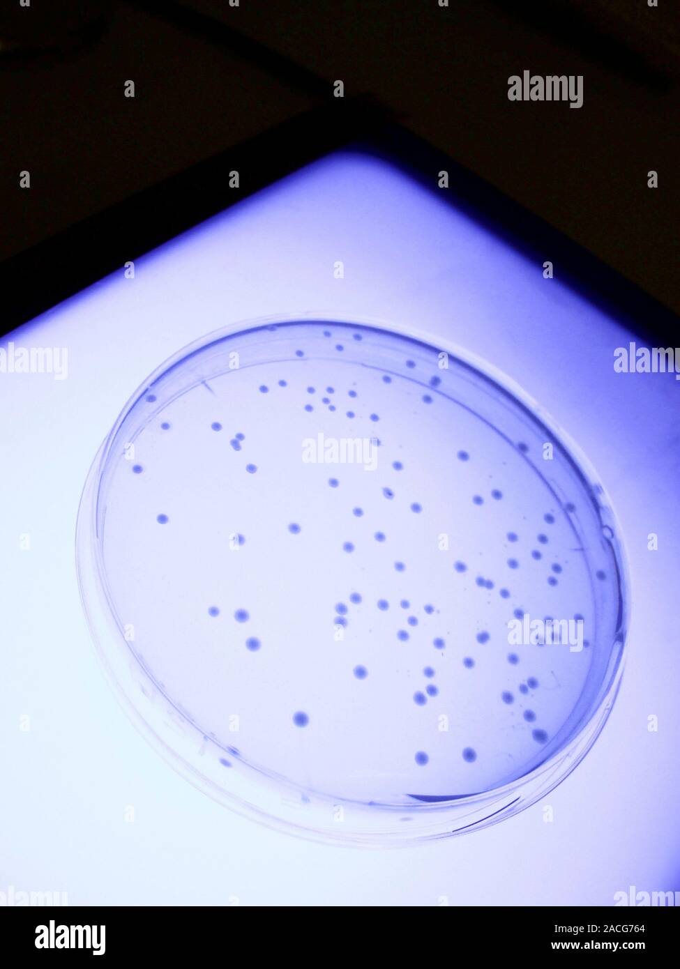 Universal Blood Type Manufacturing Petri Dish Of Cultured Bacteria Universal blood type manufacturing petri dish of cultured bacteria