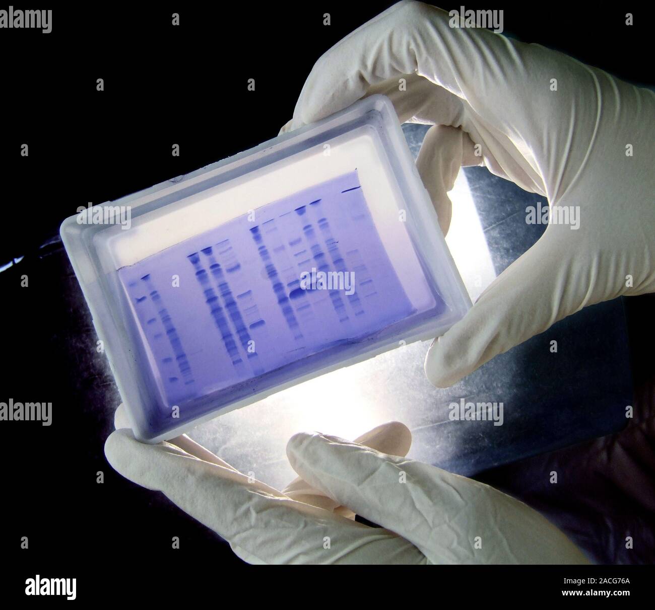 Universal Blood Type Manufacturing Electrophoresis Gel Showing The Universal blood type manufacturing electrophoresis gel showing the
