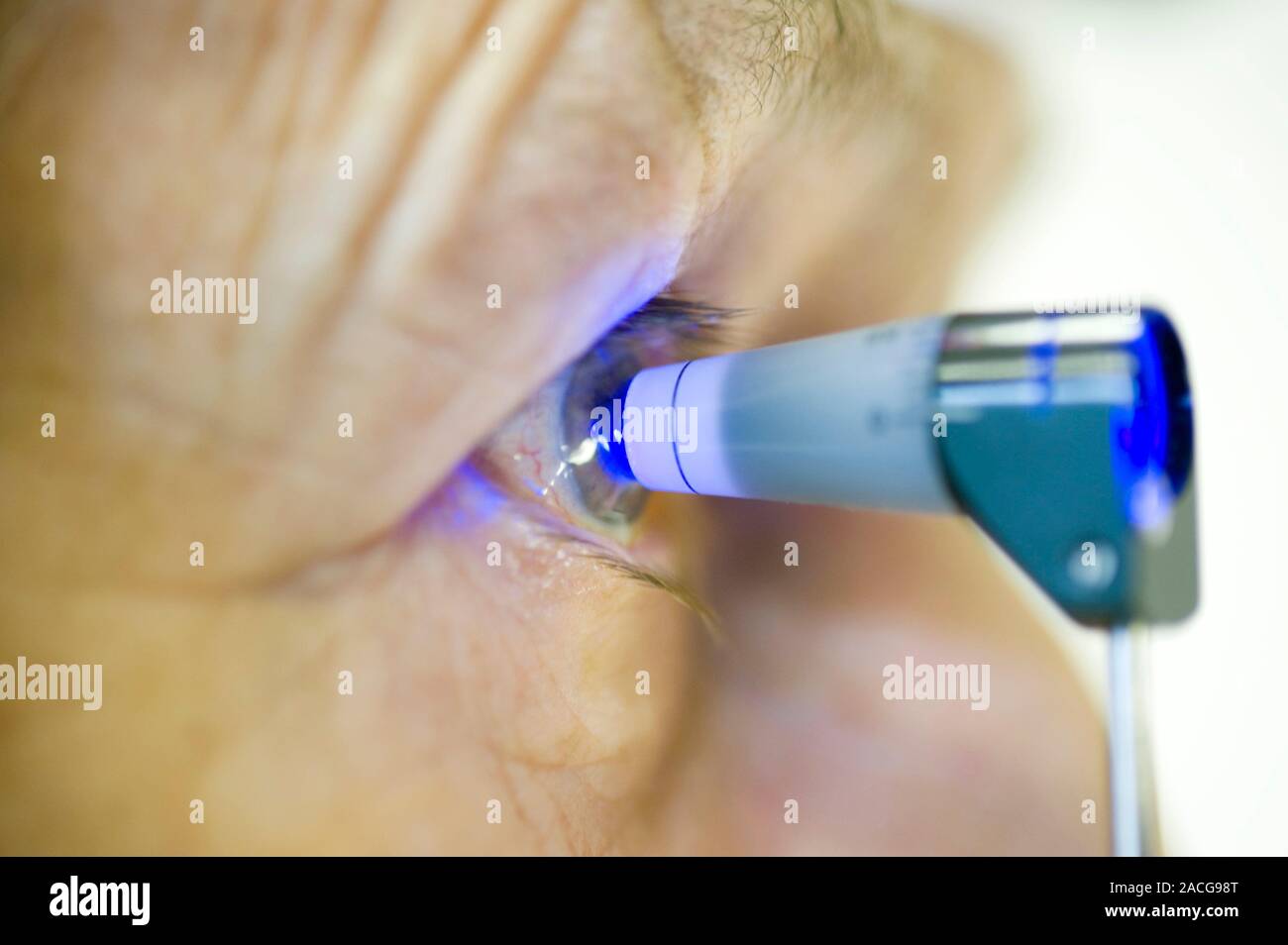 Measuring eye pressure (intraocular pressure) with a tonometer. Conditions such as