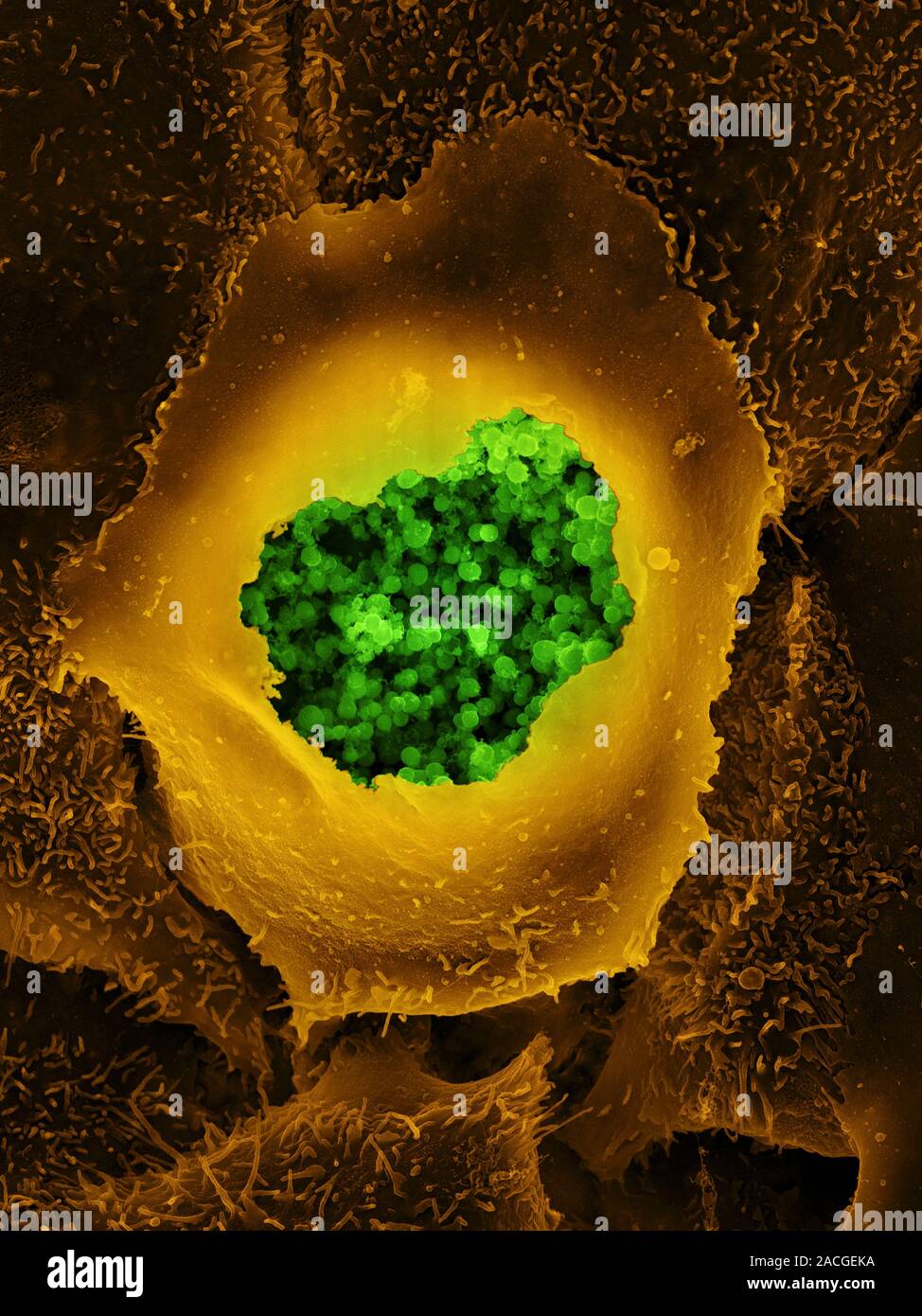 Chlamydia Coloured Scanning Electron Micrograph Sem Of Chlamydia Chlamydia Sp Bacteria 2570