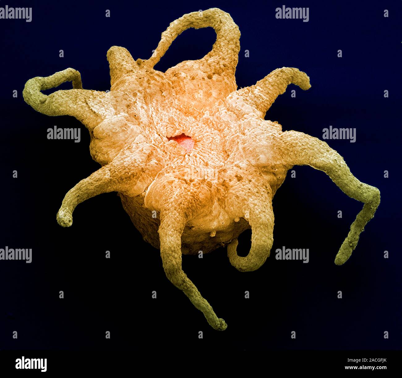 Jellyfish larva. Coloured scanning electron micrograph (SEM) of a stage